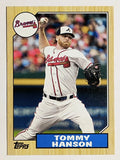 2012 Topps 1987 Topps Minis #TM32 Tommy Hanson
