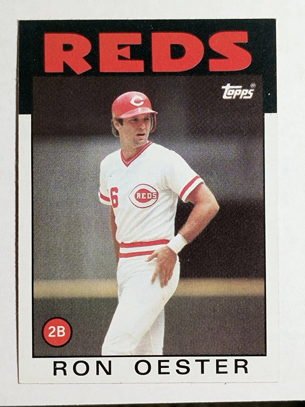 1986 Topps #627 Ron Oester